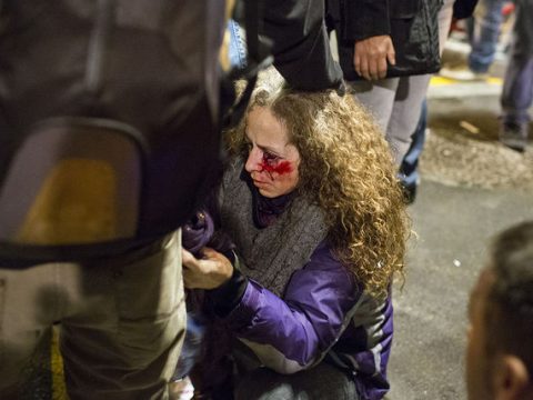 pierde-impacto-disparo-catalunya-manifestacion_eldiario
