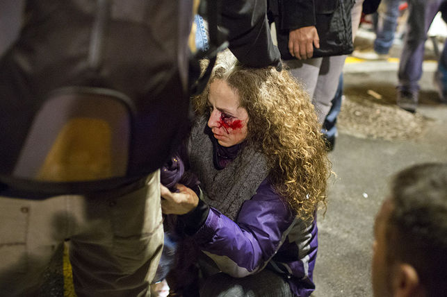 pierde-impacto-disparo-catalunya-manifestacion_eldiario